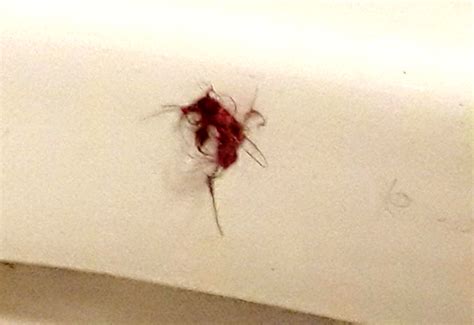 15 Little White Bugs That Look Like Lint What S That Bug 15 Little White Bugs That Look Like Lint What S That Bug
