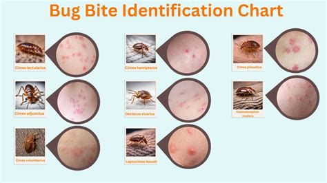 How To Identify Bed Bug Bites Pest Phobia Confopay How To Identify Bed Bug Bites Pest Phobia Confopay